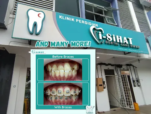I-Sihat JB Dental Clinic - Pasir Gudang